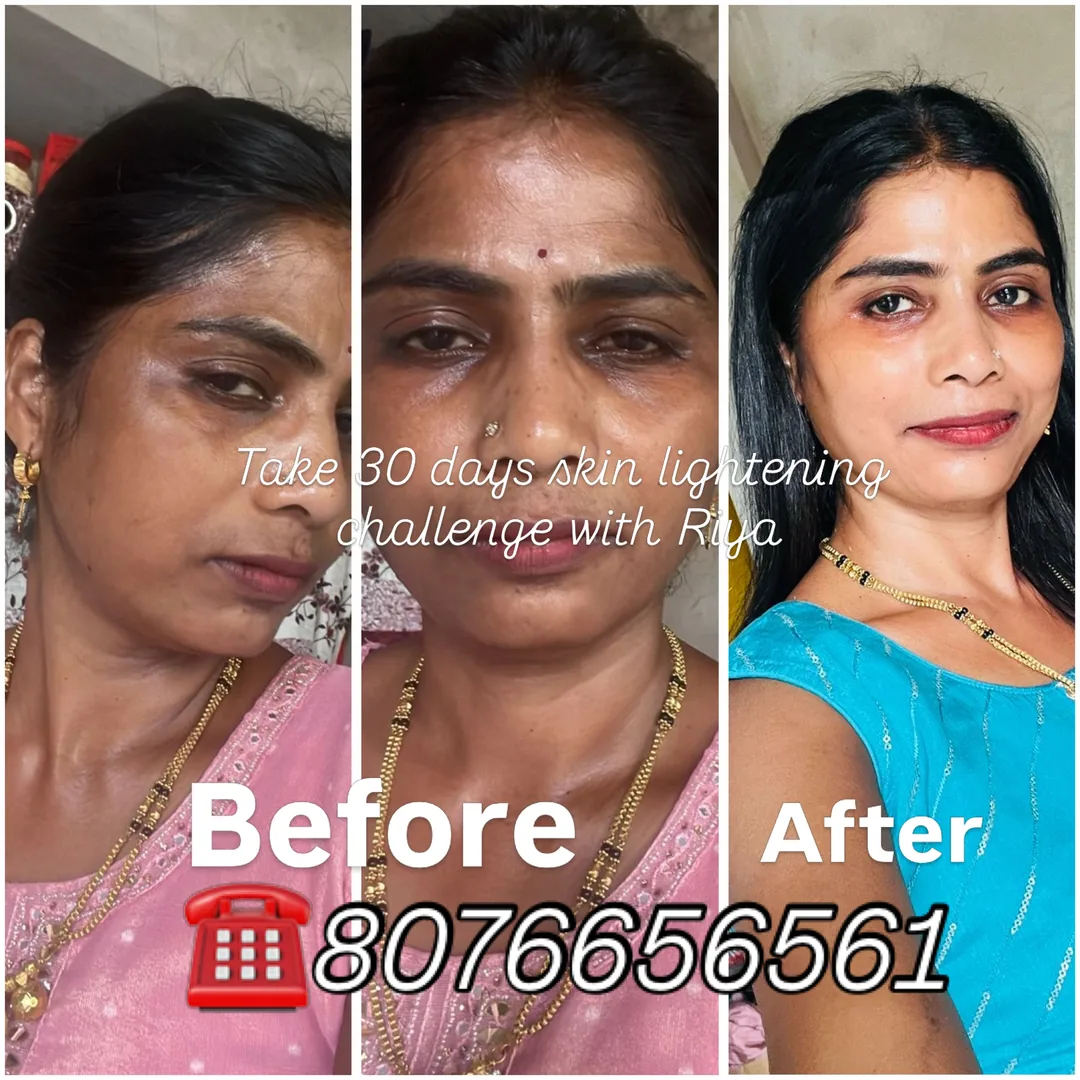 Skin brightening care — before and after